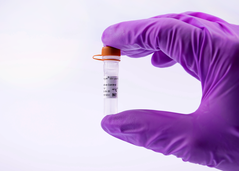 virotype IBV pan + NA Vax Positive Control