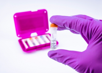 virotype CSFV 2.0 RT-PCR Kit (96 reactions) 